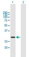 Zinc Finger BED-Type Containing 2 antibody, H00079413-B01P, Novus Biologicals, Western Blot image 
