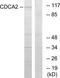 Cell Division Cycle Associated 2 antibody, TA316177, Origene, Western Blot image 