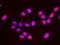 Stromal Antigen 1 antibody, GTX24455, GeneTex, Proximity Ligation Assay image 