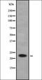 Ras-related protein Rab-1B antibody, orb338614, Biorbyt, Western Blot image 