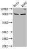 Kinesin Family Member 3C antibody, LS-C680719, Lifespan Biosciences, Western Blot image 