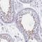 Saccharopine Dehydrogenase (Putative) antibody, HPA050775, Atlas Antibodies, Immunohistochemistry frozen image 