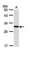 FRAT Regulator Of WNT Signaling Pathway 1 antibody, PA5-29145, Invitrogen Antibodies, Western Blot image 