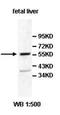 Arf-GAP with GTPase, ANK repeat and PH domain-containing protein 8 antibody, orb77508, Biorbyt, Western Blot image 