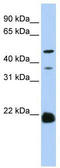 Zinc Finger DHHC-Type Containing 14 antibody, TA329473, Origene, Western Blot image 