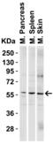 Gamma-PAK antibody, 3887, ProSci, Western Blot image 