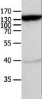 ATP Binding Cassette Subfamily C Member 5 antibody, LS-C402447, Lifespan Biosciences, Western Blot image 