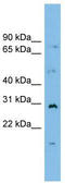 Mediator Complex Subunit 7 antibody, TA343452, Origene, Western Blot image 