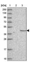 Chromosome 2 Open Reading Frame 69 antibody, NBP1-91731, Novus Biologicals, Western Blot image 
