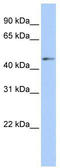 Scianna blood group antigen antibody, TA344157, Origene, Western Blot image 