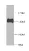 Sialophorin antibody, FNab01480, FineTest, Western Blot image 