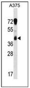 Reticulocalbin 1 antibody, AP53622PU-N, Origene, Western Blot image 