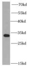 Proteasome Activator Subunit 2 antibody, FNab06895, FineTest, Western Blot image 