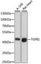 TGF beta antibody, A2124, ABclonal Technology, Western Blot image 