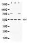 4-Aminobutyrate Aminotransferase antibody, LS-C662309, Lifespan Biosciences, Western Blot image 