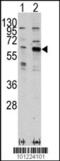 P21 (RAC1) Activated Kinase 3 antibody, 63-292, ProSci, Western Blot image 