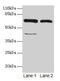 CTP Synthase 1 antibody, CSB-PA006176LA01HU, Cusabio, Western Blot image 