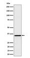 Pyrophosphatase (Inorganic) 1 antibody, M07485, Boster Biological Technology, Western Blot image 
