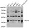 Melanocortin 1 Receptor antibody, GTX32715, GeneTex, Western Blot image 