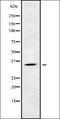 Killer Cell Immunoglobulin Like Receptor, Two Ig Domains And Short Cytoplasmic Tail 5 antibody, orb338397, Biorbyt, Western Blot image 