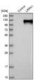 Leucine Rich Repeat Neuronal 1 antibody, NBP1-83896, Novus Biologicals, Western Blot image 