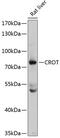 Peroxisomal carnitine O-octanoyltransferase antibody, GTX64729, GeneTex, Western Blot image 
