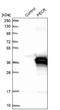 Peroxisomal trans-2-enoyl-CoA reductase antibody, NBP1-83198, Novus Biologicals, Western Blot image 