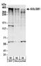 Golgin subfamily B member 1 antibody, A304-035A, Bethyl Labs, Western Blot image 