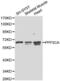 Serine/threonine-protein phosphatase 2B catalytic subunit alpha isoform antibody, LS-C192335, Lifespan Biosciences, Western Blot image 