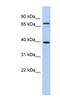 Membrane Spanning 4-Domains A14 antibody, NBP1-59621, Novus Biologicals, Western Blot image 