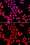 Probable O-sialoglycoprotein endopeptidase 2 antibody, GTX32768, GeneTex, Immunocytochemistry image 