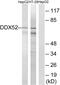 Probable ATP-dependent RNA helicase DDX52 antibody, GTX86965, GeneTex, Western Blot image 