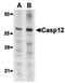 Caspase-12 antibody, orb74515, Biorbyt, Western Blot image 