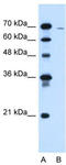 Chloride Channel CLIC Like 1 antibody, TA335946, Origene, Western Blot image 