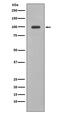 Nuclear Factor, Erythroid 2 Like 2 antibody, M00078, Boster Biological Technology, Western Blot image 