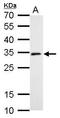 Kinetochore-associated protein NSL1 homolog antibody, TA308390, Origene, Western Blot image 