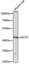 Glycine C-Acetyltransferase antibody, A07144, Boster Biological Technology, Western Blot image 