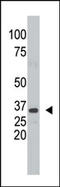 Stp antibody, AP12295PU-N, Origene, Western Blot image 