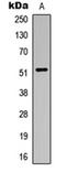 Aldehyde Dehydrogenase 3 Family Member B1 antibody, orb235006, Biorbyt, Western Blot image 