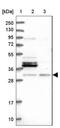 N(Alpha)-Acetyltransferase 80, NatH Catalytic Subunit antibody, NBP1-89812, Novus Biologicals, Western Blot image 