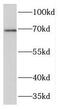 Protein-glutamine gamma-glutamyltransferase 4 antibody, FNab08651, FineTest, Western Blot image 