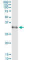 Homeobox B1 antibody, LS-C139493, Lifespan Biosciences, Immunoprecipitation image 