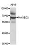 Melanoma-associated antigen D2 antibody, STJ24448, St John