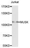 Muscle Associated Receptor Tyrosine Kinase antibody, LS-C332191, Lifespan Biosciences, Western Blot image 
