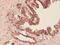 Phosphoglycerate Dehydrogenase antibody, ab57030, Abcam, Immunohistochemistry paraffin image 