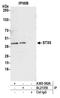 STX5 antibody, A305-382A, Bethyl Labs, Immunoprecipitation image 