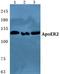 Low-density lipoprotein receptor-related protein 8 antibody, A03444-1, Boster Biological Technology, Western Blot image 