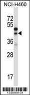 Connective tissue growth factor antibody, 57-030, ProSci, Western Blot image 