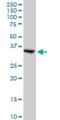 Small Glutamine Rich Tetratricopeptide Repeat Containing Alpha antibody, H00006449-B01P, Novus Biologicals, Western Blot image 