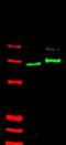 Zinc finger protein GLI2 antibody, AP09002PU-N, Origene, Western Blot image 